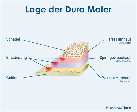 Dura.